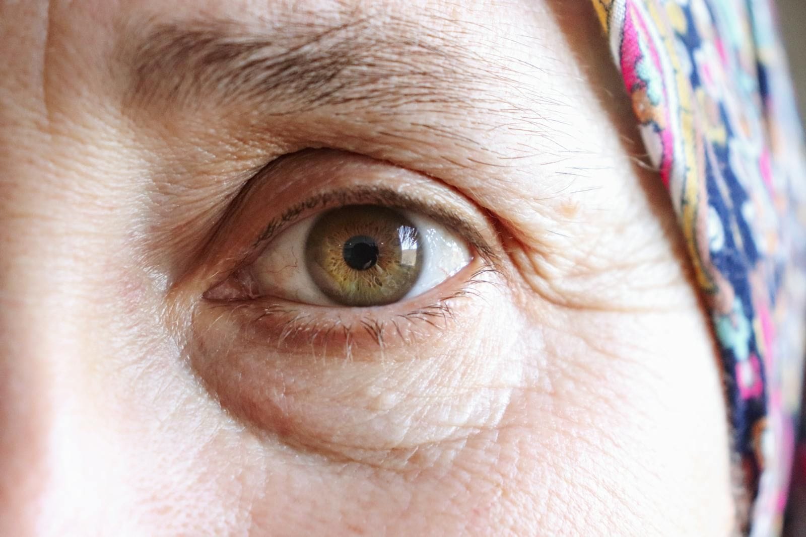 Extreme close-up of an older woman's eye with the iris, lashes, and fine skin texture in sharp focus, a colorful headscarf softly blurred behind her, the eye being the focus of cataract surgery